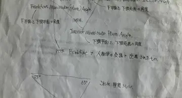 Blog post thumbnail for 矯正歯科医さんとハナシをするための事前知識を勉強する