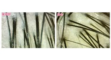 Blog post thumbnail for SBC 体験記、およびアデランス体験後の所感